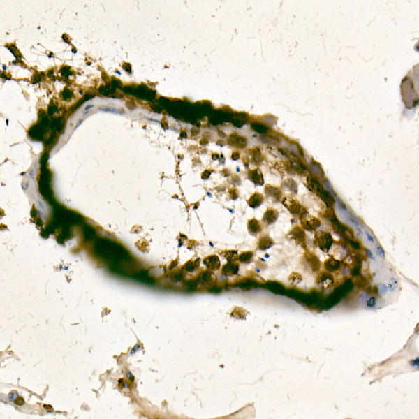 Immunohistochemistry of paraffin-embedded human testis using TET1 Rabbit mAb at dilution of 1:1600 (40x lens). Perform high pressure antigen retrieval with 10 mM citrate buffer pH 6. 0 before commencing with IHC staining protocol.