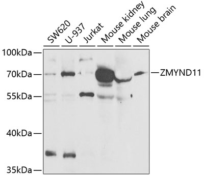 Anti-ZMYND11 Antibody (CAB6327)