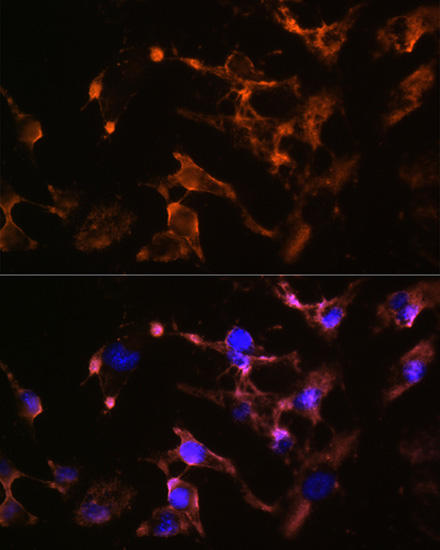 Anti-AMPH Antibody (CAB5389)