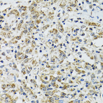 Anti-TXN2 Antibody (CAB6782)