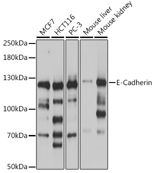 Anti-E-Cadherin Antibody (CAB16811)