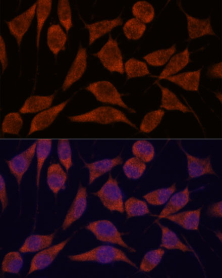 Anti-TRAPPC6A Antibody (CAB16143)