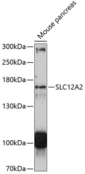 Anti-SLC12A2 Antibody (CAB11675)