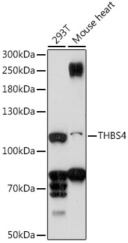 Anti-THBS4 Antibody (CAB16438)