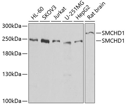 Anti-SMCHD1 Antibody (CAB7214)