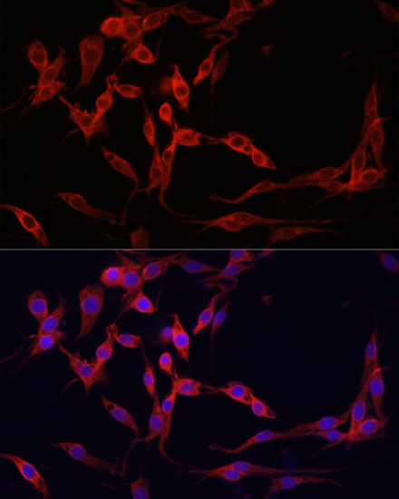 Anti-YAP1 Antibody [KO Validated] (CAB11264)