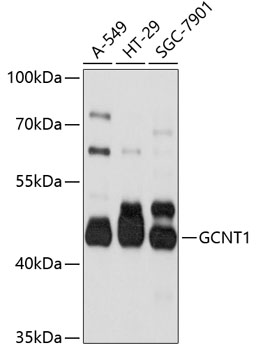 Anti-GCNT1 Antibody (CAB10842)