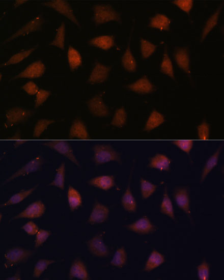 Anti-TREX1 Antibody (CAB6778)