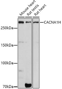 Western blot analysis of extracts of various cell lines, using CACNA1H antibody at 1:1000 dilution. Secondary antibody: HRP Goat Anti-Rabbit IgG (H+L) at 1:10000 dilution. Lysates/proteins: 25ug per lane. Blocking buffer: 3% nonfat dry milk in TBST. Detection: ECL Basic Kit. Exposure time: 180s.