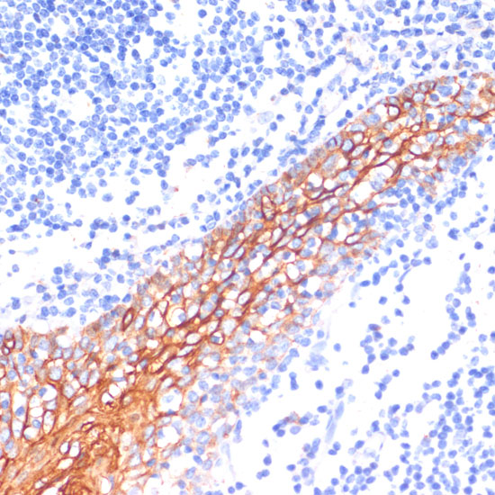 Anti-E-Cadherin Antibody (CAB3044)