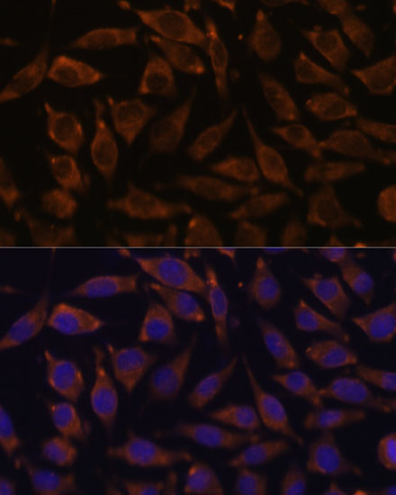 Anti-NOTCH2 Antibody (CAB0560)