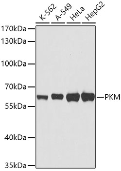 Anti-PKM Mouse Monoclonal Antibody (CAB0540)