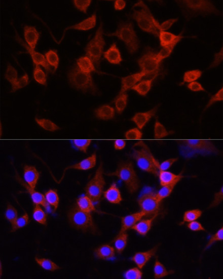 Anti-SERPINA1 Antibody (CAB12481)