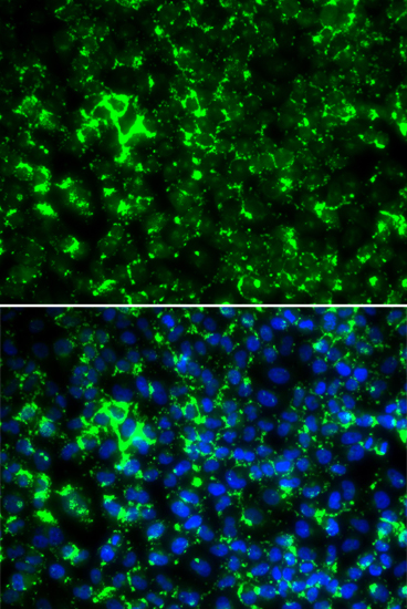 Anti-KCNA2 Antibody (CAB6295)