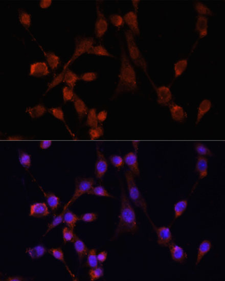 Anti-MOV10 Antibody (CAB3966)