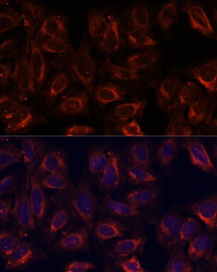 Anti-SCGB3A2 Antibody (CAB13137)