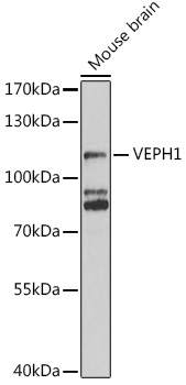 Anti-VEPH1 Polyclonal Antibody (CAB8510)