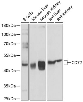 Anti-CD72 Polyclonal Antibody (CAB9930)