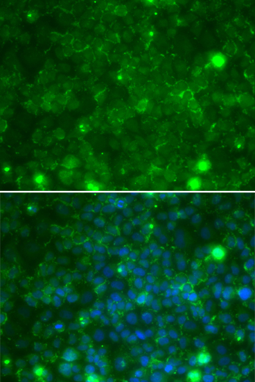 Anti-TIMP3 Antibody (CAB1511)