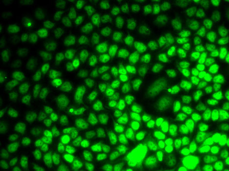 Anti-Cyclin E2 Antibody (CAB7032)