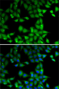 Anti-MPI Antibody (CAB7319)