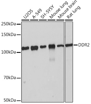 Anti-DDR2 Antibody (CAB4296)