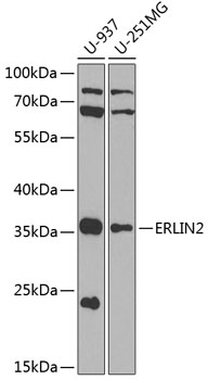 Anti-Erlin-2 Polyclonal Antibody (CAB8314)