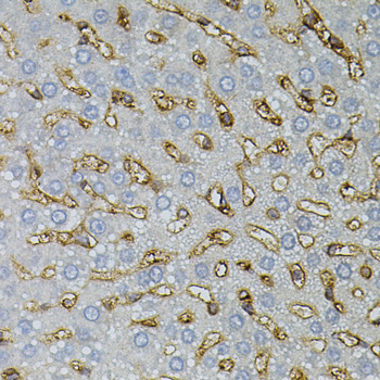 Anti-Neutral ceramidase Polyclonal Antibody (CAB7985)