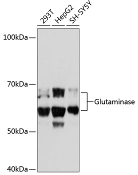 Anti-Glutaminase Antibody