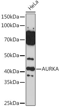 Anti-AURKA Antibody (CAB2121)