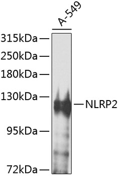 Anti-NLRP2 Polyclonal Antibody (CAB8233)