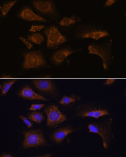 Anti-RPS25 Antibody (CAB15314)