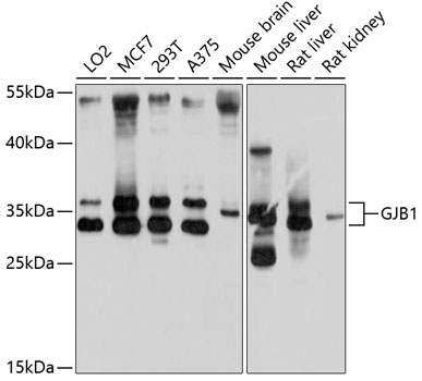 Anti-GJB1 Antibody (CAB10112)