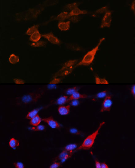 Anti-CD98 Antibody (CAB5702)