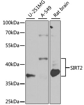 Anti-SIRT2 Antibody (CAB0273)