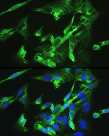 Anti-BMPR2 Antibody (CAB5666)