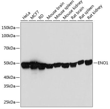 Anti-ENO1 Antibody