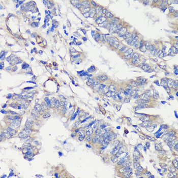 Anti-TNF-Alpha Antibody (CAB0277)