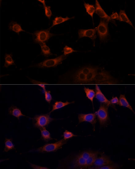 Anti-WWOX Antibody (CAB12652)