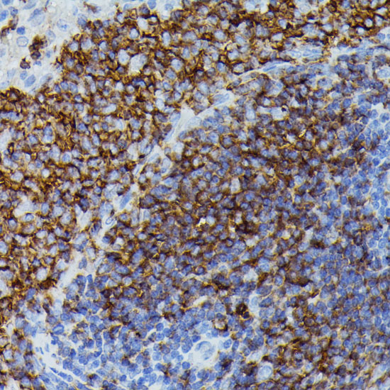 Anti-APOC3 Antibody (CAB1409)