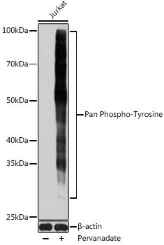 Anti-Pan Phospho-Tyrosine Antibody (CABP0973)