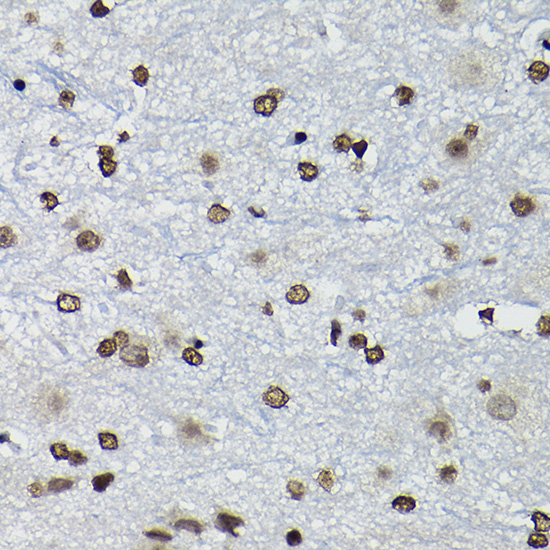 Anti-Cyclin K Antibody (CAB10261)