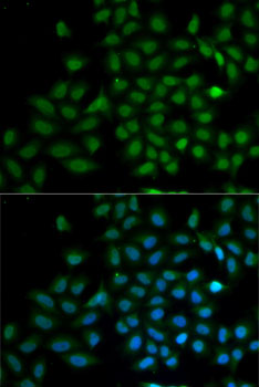 Anti-KLF10 Antibody (CAB6415)