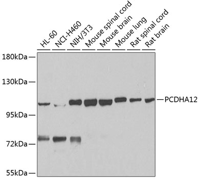 Anti-PCDHA12 Polyclonal Antibody (CAB8501)