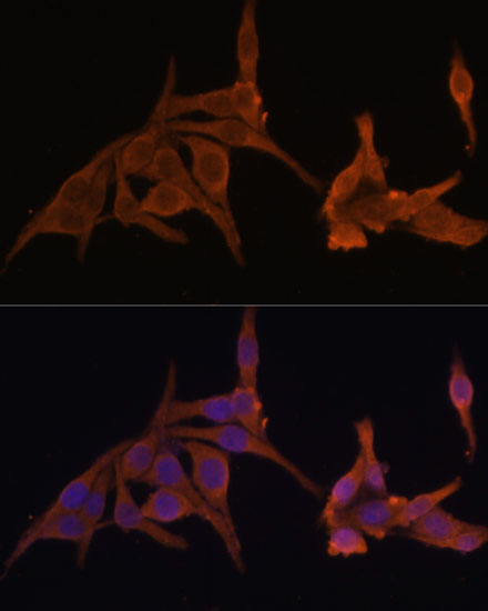 Anti-PRKAB2 Antibody (CAB6952)