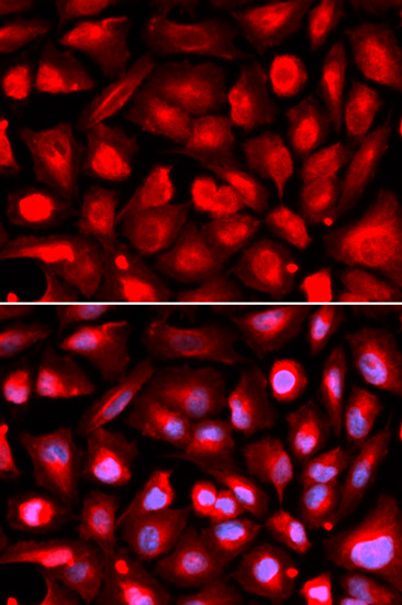 Anti-ETS1 Antibody (CAB13302)