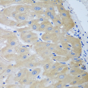 Anti-NME4 Polyclonal Antibody (CAB8350)