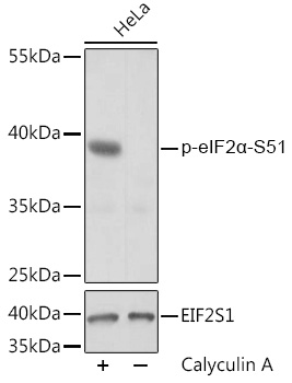 Anti-Phospho-eIF2alpha-S51 Antibody (CABP0745)