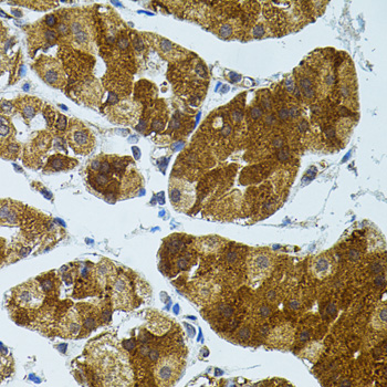 Anti-CETP Antibody (CAB1355)