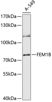 Anti-FEM1B Antibody (CAB12802)